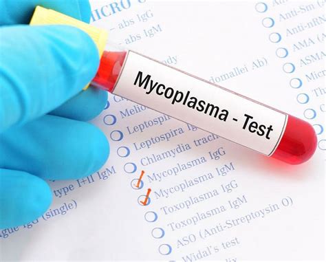 does mycoplasma survive autoclave|Mycoplasma pneumoniae and Its Role a.